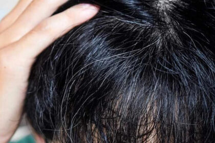 Reverse Your Premature Grey Hair