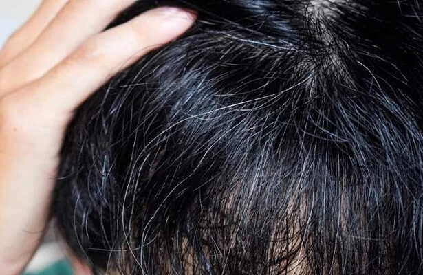 Reverse Your Premature Grey Hair