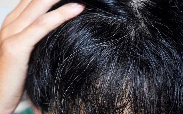 Reverse Your Premature Grey Hair